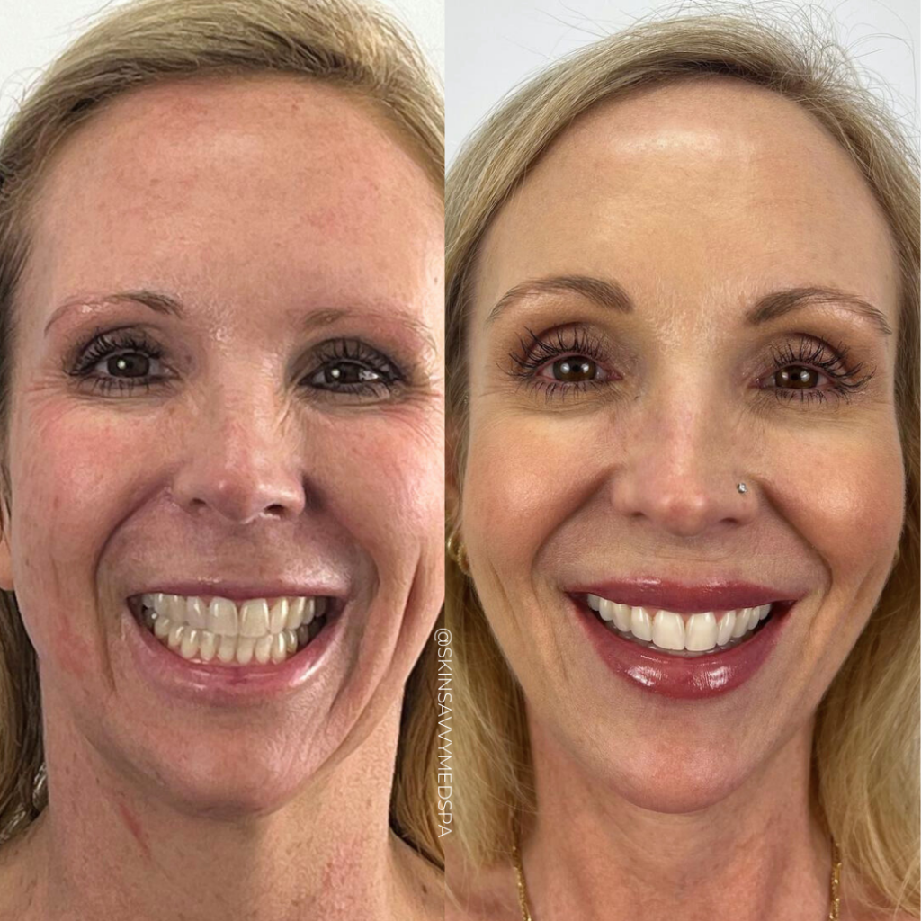 Sara Wilkening Savvy Regimen